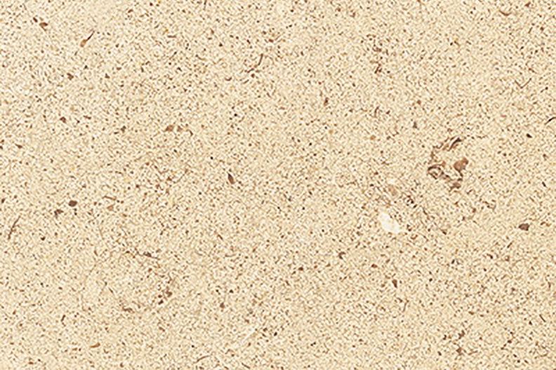 Portugal Beige Marble - Jaddas Stone Portugal Beige Marble